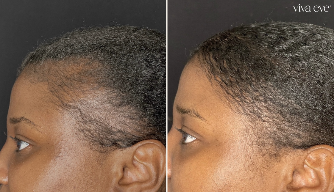 Before and After Cosmetic Dermatology