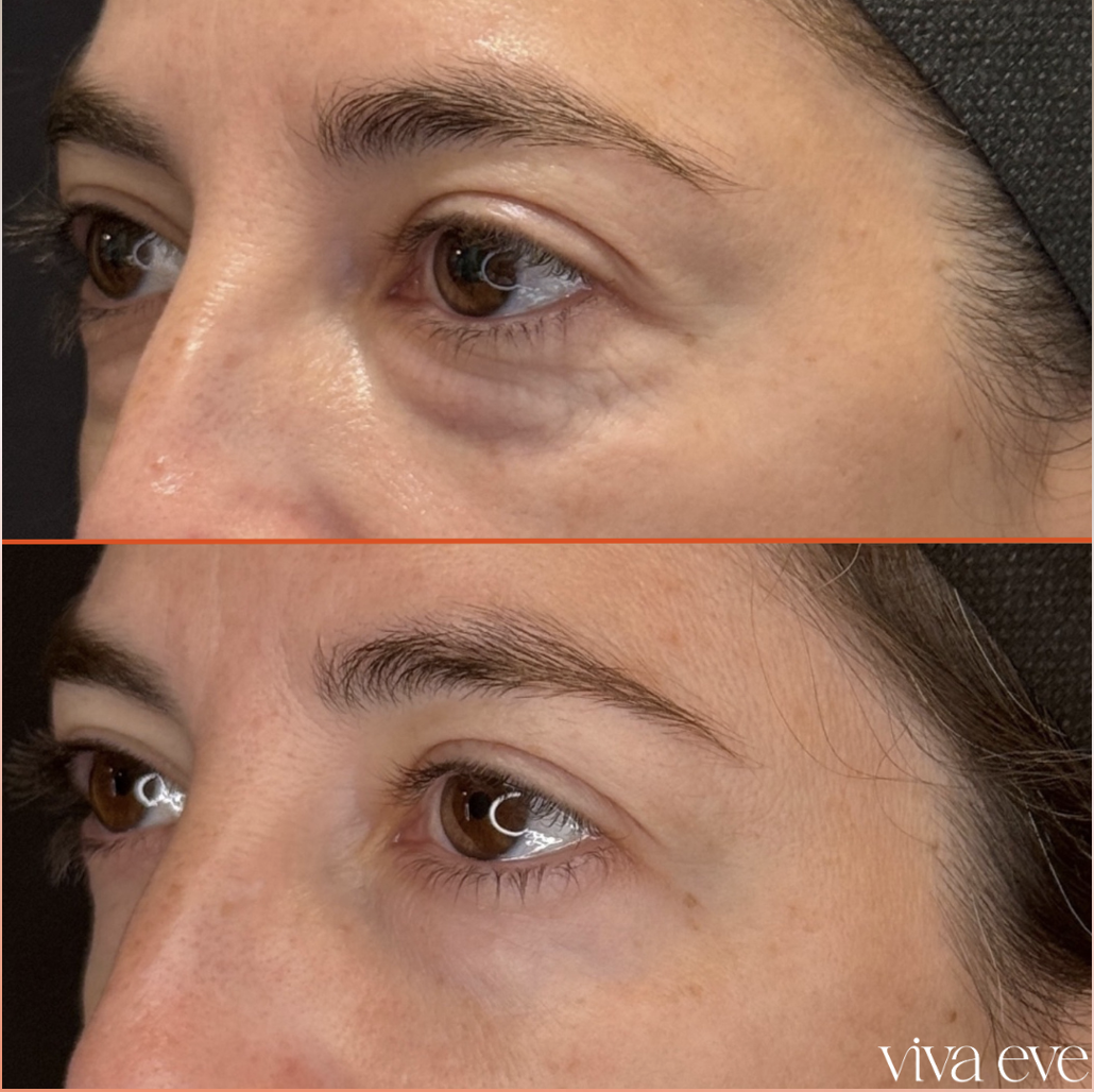 Before and After Cosmetic Dermatology