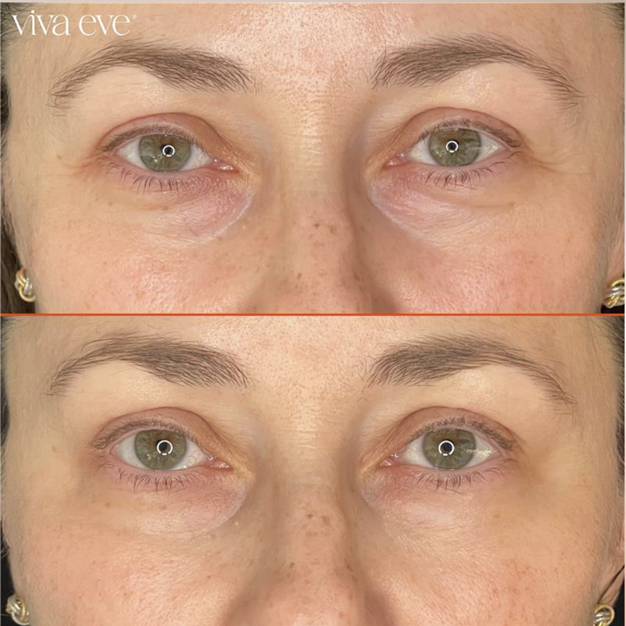 Before and After Cosmetic Dermatology